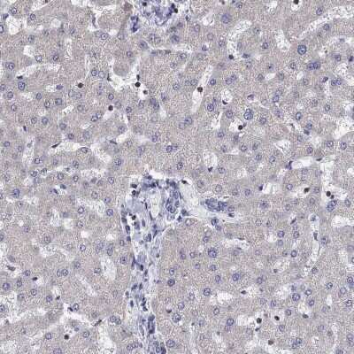Immunohistochemistry-Paraffin: AGAP2 Antibody [NBP3-16972]