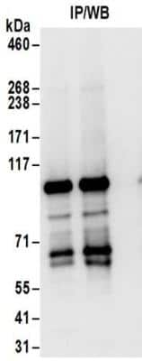 Immunoprecipitation: AGAP2 Antibody [NBP2-32176]