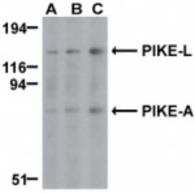 Western Blot: AGAP2 AntibodyBSA Free [NBP1-77194]