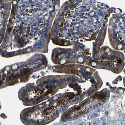 Immunohistochemistry-Paraffin: AGAP3 Antibody [NBP1-85685]