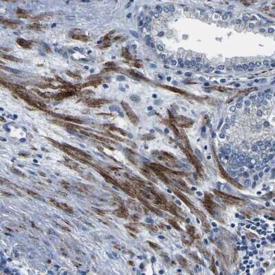 Immunohistochemistry-Paraffin: AGAP3 Antibody [NBP1-85685]