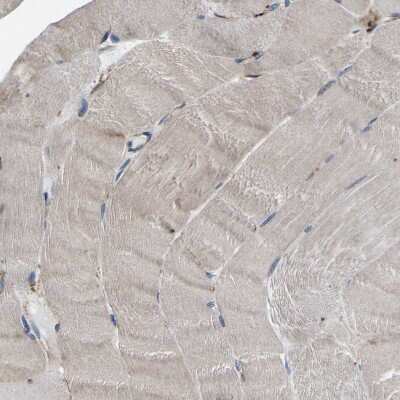 Immunohistochemistry-Paraffin: AGAP3 Antibody [NBP1-85685]