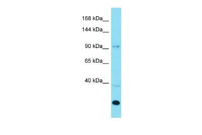 Western Blot: AGAP3 Antibody [NBP2-86961]