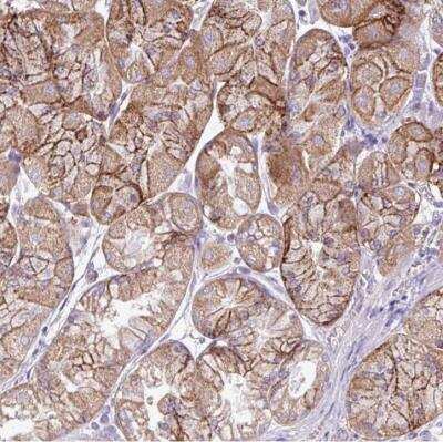 Immunohistochemistry-Paraffin: AGAP4 Antibody [NBP2-54699]