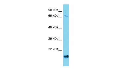 Western Blot: AGAP4 Antibody [NBP2-84408]