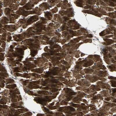 Immunohistochemistry-Paraffin: AGBL2 Antibody [NBP1-83581]