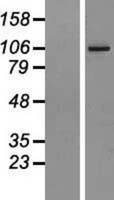 Western Blot: AGBL2 Overexpression Lysate [NBL1-07378]