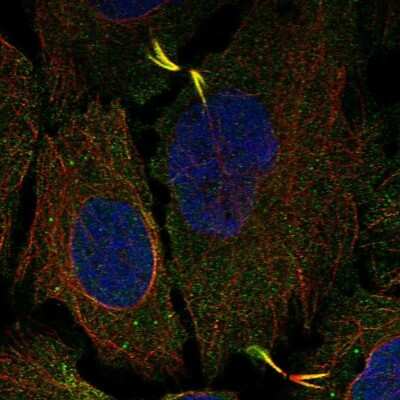 Immunocytochemistry/ Immunofluorescence: AGBL5 Antibody [NBP1-83616]