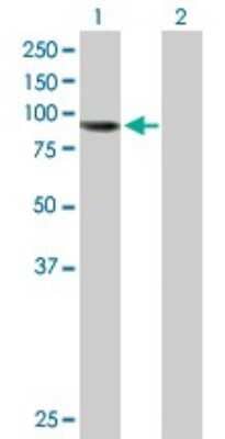 Western Blot: AGBL5 Antibody [H00060509-B01P]