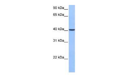 Western Blot: AGBL5 Antibody [NBP3-10627]