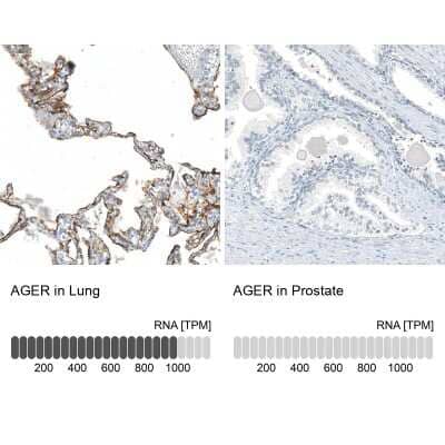 Immunohistochemistry-Paraffin: AGER Antibody (CL10587) [NBP3-07982]