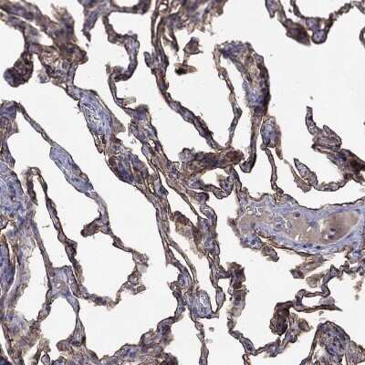 Immunohistochemistry-Paraffin: AGER Antibody [NBP3-16981]