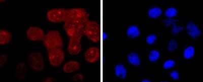 Immunocytochemistry/ Immunofluorescence: AGER Antibody (JF0975) [NBP2-67095]