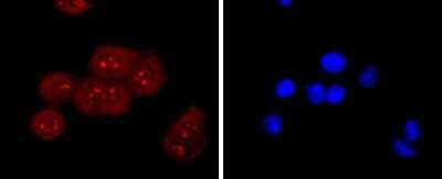 Immunocytochemistry/ Immunofluorescence: AGER Antibody (JF0975) [NBP2-67095]