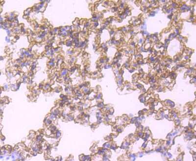 Immunohistochemistry-Paraffin: AGER Antibody (JF0975) [NBP2-67095]