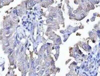 Immunohistochemistry-Paraffin: AGER Antibody (JF0975) [NBP2-67095]