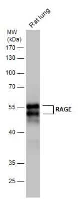 Western Blot: AGER Antibody [NBP3-13484]