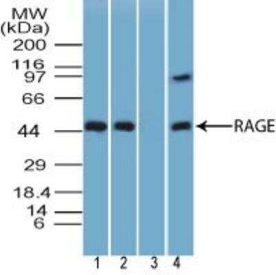 Western Blot: AGER Antibody [NBP3-18000]