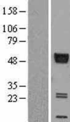 Western Blot: AGER Overexpression Lysate [NBL1-07379]