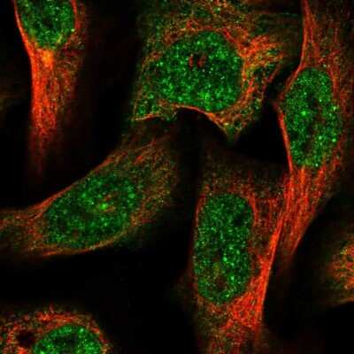 Immunocytochemistry/ Immunofluorescence: AGL Antibody [NBP1-89440]