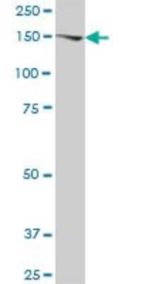 Western Blot: AGL Antibody [H00000178-B01P]