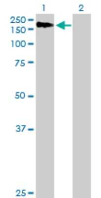 Western Blot: AGL Antibody [H00000178-B01P]