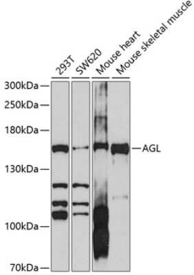 Western Blot: AGL AntibodyBSA Free [NBP2-91993]