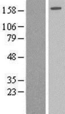 Western Blot: AGL Overexpression Lysate [NBL1-07380]