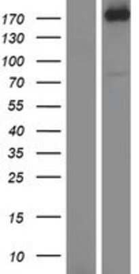 Western Blot: AGL Overexpression Lysate [NBP2-09001]