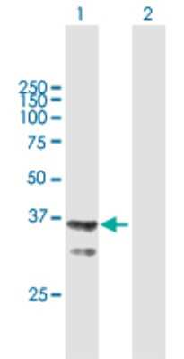 Western Blot: AGMAT Antibody [H00079814-B01P]