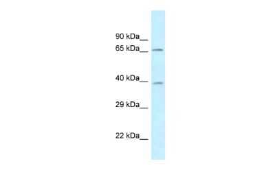 Western Blot: AGMAT Antibody [NBP2-86962]