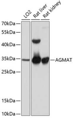 Western Blot: AGMAT AntibodyAzide and BSA Free [NBP2-92061]