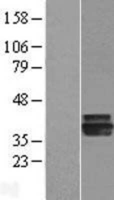 Western Blot: AGMAT Overexpression Lysate [NBL1-07381]