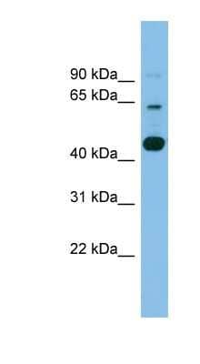 Western Blot: AGMO Antibody [NBP1-70404]