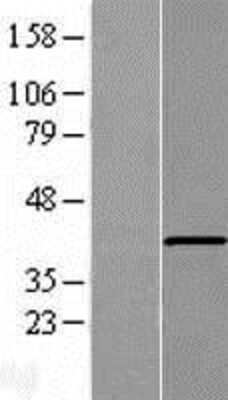 Western Blot: AGMO Overexpression Lysate [NBP2-08864]