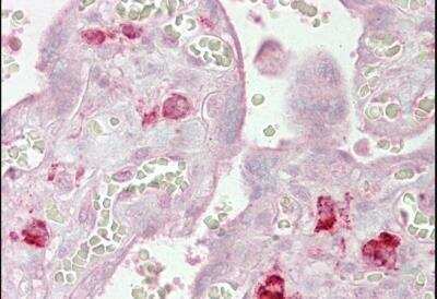 Immunohistochemistry-Paraffin: AGO1/EIF2C1 Antibody [NB100-2817]