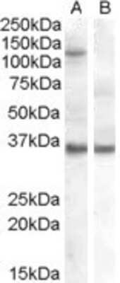 Western Blot: AGO1/EIF2C1 Antibody [NB100-2817]