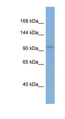 Western Blot: AGO1/EIF2C1 Antibody [NBP1-56530]