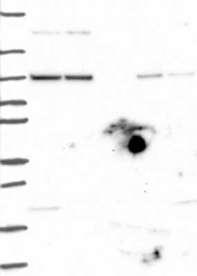 Western Blot: AGO1/EIF2C1 Antibody [NBP3-17209]