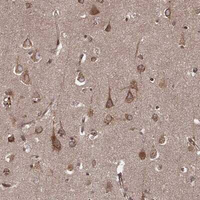 Immunohistochemistry-Paraffin: AGPAT1 Antibody [NBP2-57898]