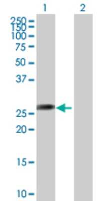 Western Blot: AGPAT1 Antibody [H00010554-B01P]