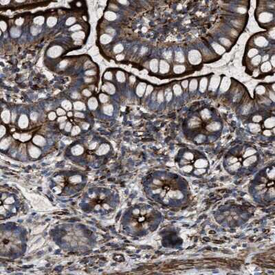 Immunohistochemistry-Paraffin: AGPAT2 Antibody [NBP1-88499]