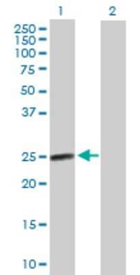 Western Blot: AGPAT2 Antibody [H00010555-B01P]