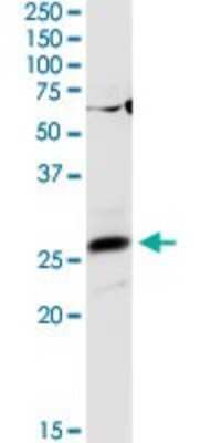 Western Blot: AGPAT2 Antibody [H00010555-D01P]