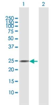 Western Blot: AGPAT2 Antibody [H00010555-D01P]
