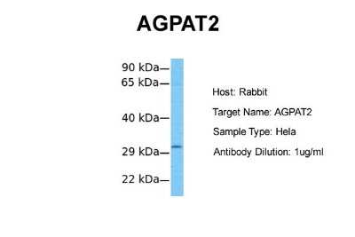 Western Blot: AGPAT2 Antibody [NBP1-59734]