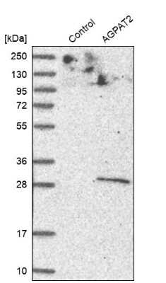 Western Blot: AGPAT2 Antibody [NBP1-88499]