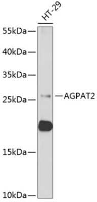 Western Blot: AGPAT2 AntibodyBSA Free [NBP2-92662]