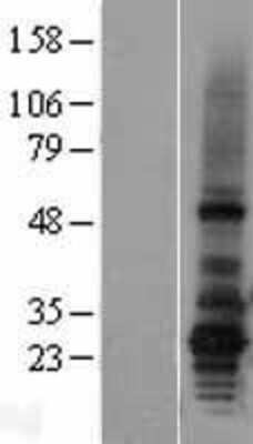 Western Blot: AGPAT2 Overexpression Lysate [NBL1-07383]