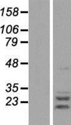 Western Blot: AGPAT2 Overexpression Lysate [NBP2-09143]